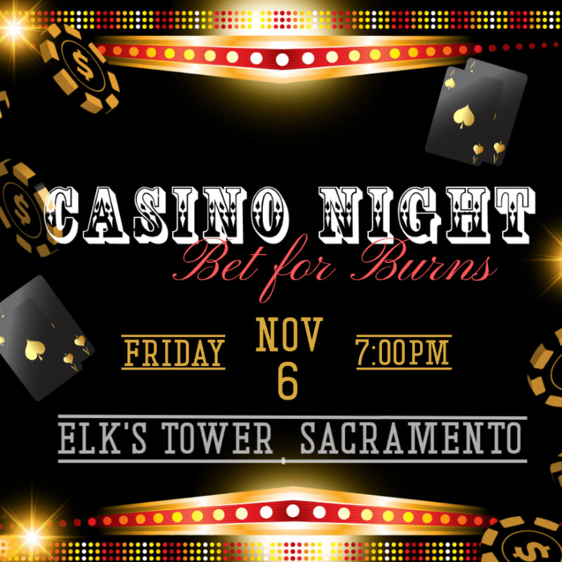 Casino chips and playing cards are scattered across the foreground, with the text "CASINO NIGHT Bet for Burns" prominently displayed against a black background illuminated by festive lights.