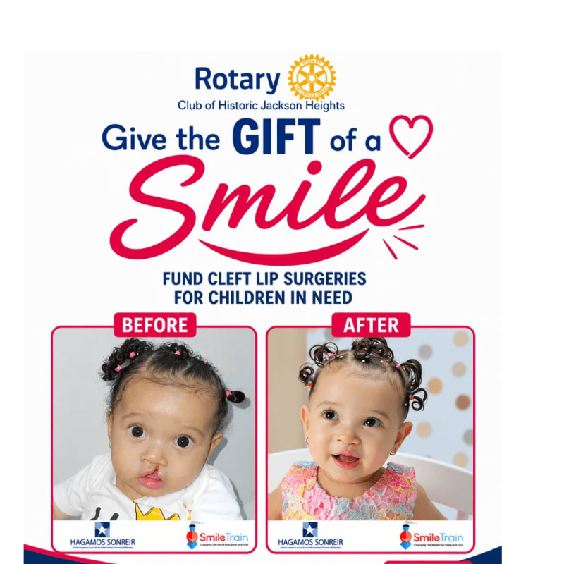 A Rotary Club poster features a "before and after" comparison of a child's cleft lip surgery in the foreground, with the Rotary logo and a call to action for donations in the background.