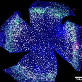 Healthy corneal macrophages item