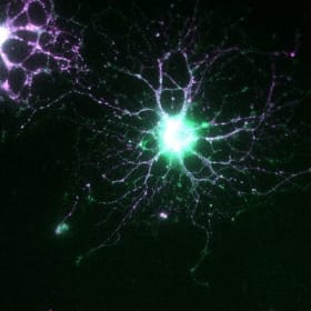 Central Network: A Closer Look at Oligodendrocytes item