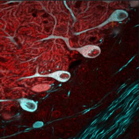 Calcium channels in cerebellar Purkinje cells item