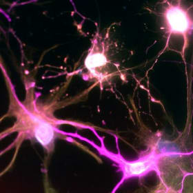 Glial Interactions: Illuminating Oligodendro & Astro -cytes item