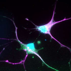 Cellular Conversation: The Touch of Astrocytes item