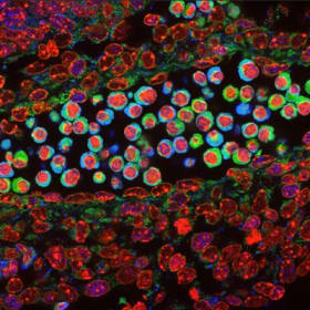 Matrix in Bone Marrow item