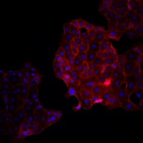 Early Harmonies: Self-Lung Organoid Assembly in Progress item