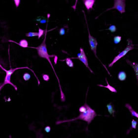Microglia constellations item
