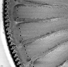 Ellerbeckia sol, Valve detail on red seaweed item