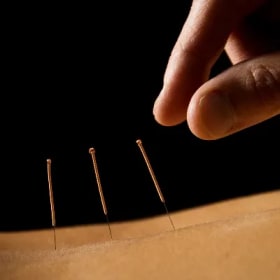 Tap Into Your Qi – Healing with Acupuncture and Acupressure item