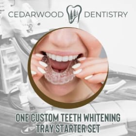 #2: One Custom Teeth Whitening Tray Starter Set--$250 Value item