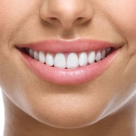 Zoom Teeth Whitening item