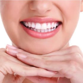 Teeth Whitening Trays from Beyond Smiles DentaSpa item