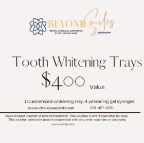 Teeth Whitening Trays from Beyond Smiles DentaSpa item
