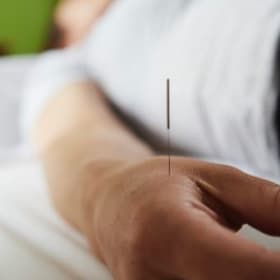 Oaktree Medical Acupuncture or Chiropractor Session item