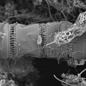 Ellerbeckia sol, Valve detail on red seaweed item