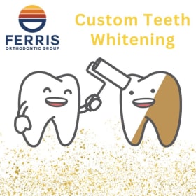 Custom Teeth Whitening item