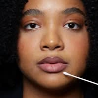 V/O MedSpa Naperville Lip Flip item