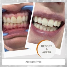 Adorn Lifestyle item