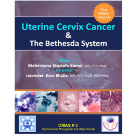 Uterine Cervix Cancer The Bethesda System: CMAS # 3 item