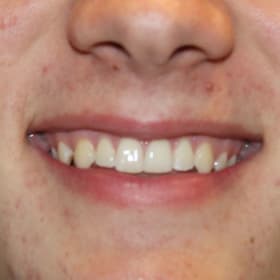 Contestant 1   Best Smile item