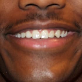 Contestant 2          Best Smile item