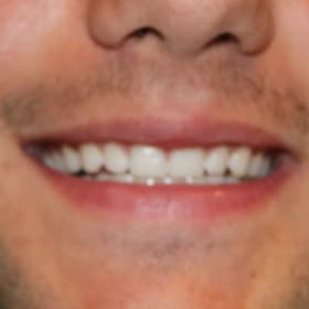 Contestant 4       Best Smile item