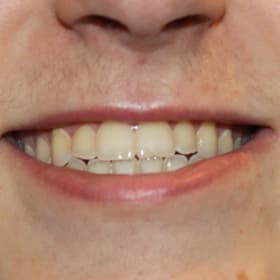 Contestant 5     Best Smile item