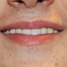 Contestant 7     Best Smile item