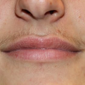 Contestant 8      Best Smile item