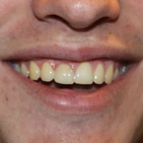 Contestant 9      Best Smile item