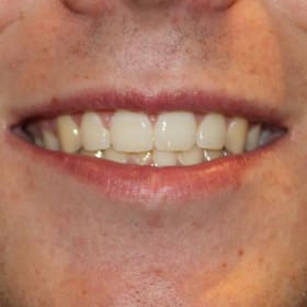 Contestant 10      Best Smile item