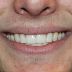 Contestant 11      Best Smile item