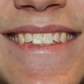 Constant 13      Best Smile item