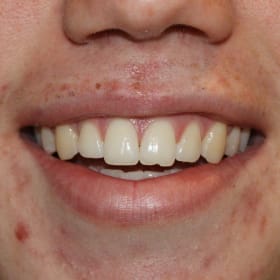 Contestant 14         Best Smile item