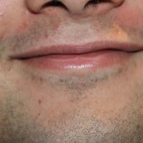 Contestant 15        Best Smile item