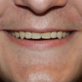 Contestant 18        Best Smile item