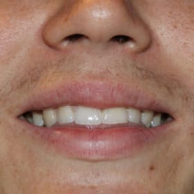 Contestant 19      Best Smile item