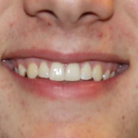 Contestant 1    Audience Choice item