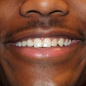 Contestant 2      Audience Choice item