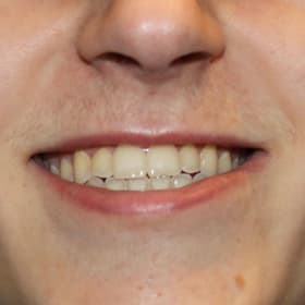 Contestant 5      Audience Choice item