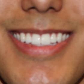 Contestant 6       Audience Choice item