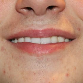 Contestant 7      Audience Choice item