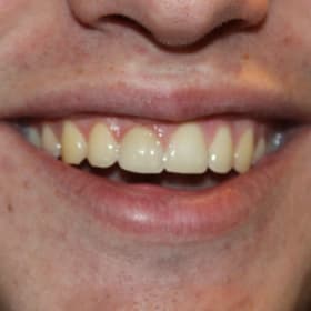 Contestant 9    Audience Choice item