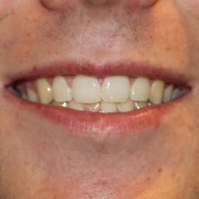 Contestant 10     Audience Choice item