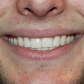 Contestant 11 Audience Choice item