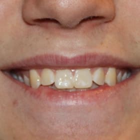 Contestant 13    Audience Choice item