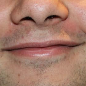 Contestant 15   Audience Choice item