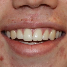 Contestant 14    Audience Choice item