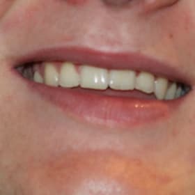 Contestant 16   Audience Choice item