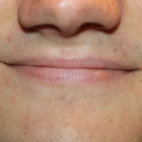 Contestant 17    Audience  Choice item