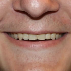 Contestant 18      Audience Choice item